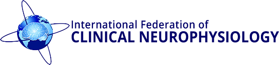 EMG in Treatment with Botulinum Toxin